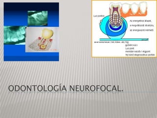 Odontología neurofocal. 