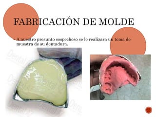  A nuestro presunto sospechoso se le realizara un toma de
muestra de su dentadura.
 