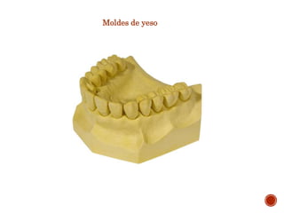 Moldes de yeso
 