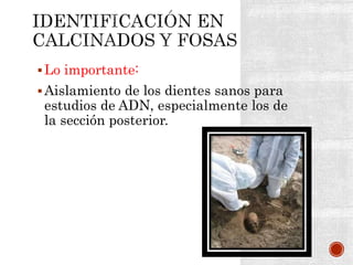 Lo importante:
Aislamiento de los dientes sanos para
estudios de ADN, especialmente los de
la sección posterior.
 
