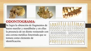 Se logra la obtención de fragmentos de
hueso maxilar y mandibular y en ellas
la presencia de un diente restaurado con
una corona metálica fenestrada que se
tomara como elemento de
identificación.
 