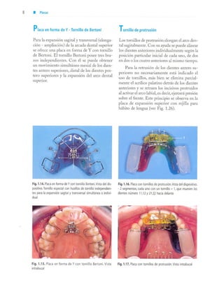 aparatología en ortopedia funcional.