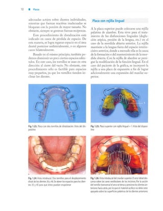 aparatología en ortopedia funcional.