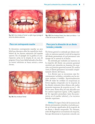 aparatología en ortopedia funcional.