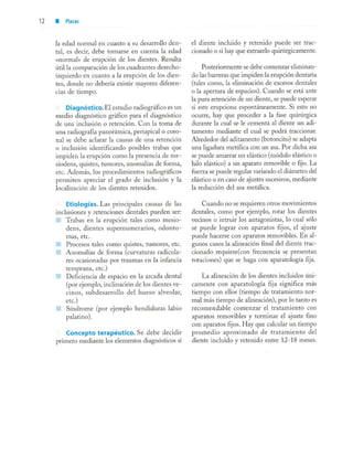 aparatología en ortopedia funcional.