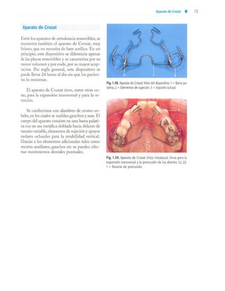 aparatología en ortopedia funcional.