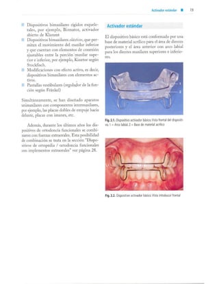 aparatología en ortopedia funcional.