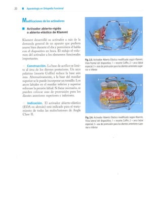 aparatología en ortopedia funcional.