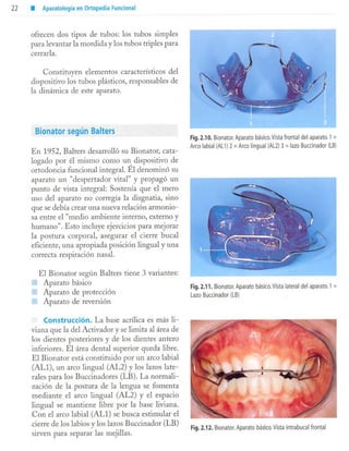 aparatología en ortopedia funcional.