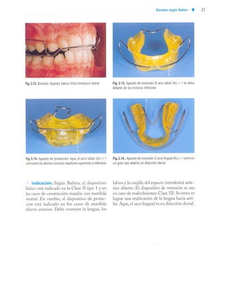 aparatología en ortopedia funcional.