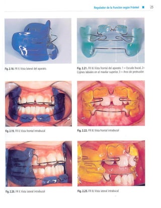 aparatología en ortopedia funcional.