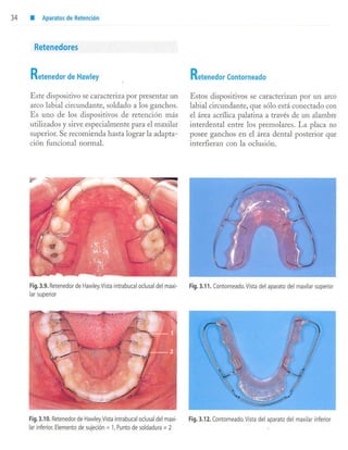 aparatología en ortopedia funcional.