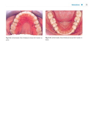 aparatología en ortopedia funcional.