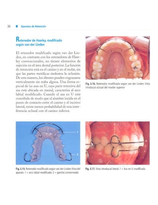 aparatología en ortopedia funcional.