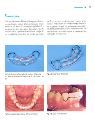 aparatología en ortopedia funcional.
