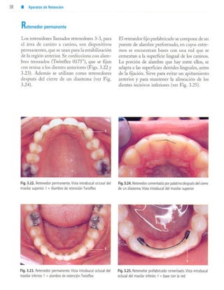 aparatología en ortopedia funcional.