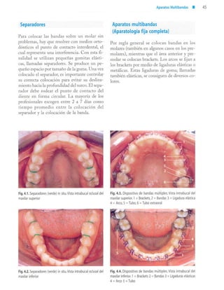 aparatología en ortopedia funcional.