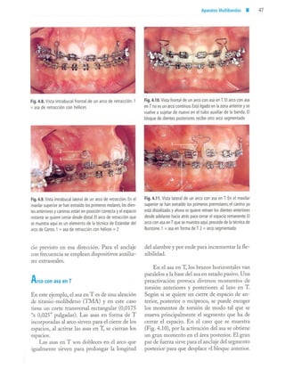 aparatología en ortopedia funcional.