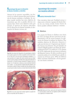 aparatología en ortopedia funcional.