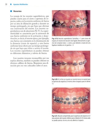 aparatología en ortopedia funcional.