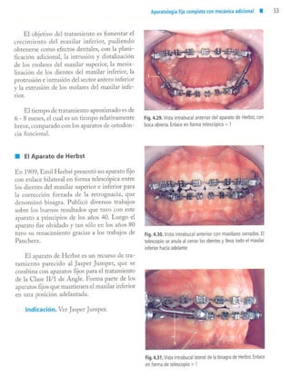 aparatología en ortopedia funcional.