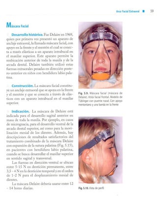 aparatología en ortopedia funcional.