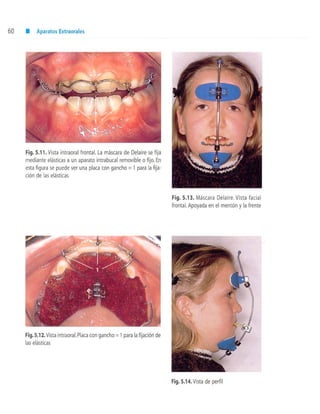 aparatología en ortopedia funcional.