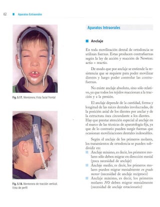 aparatología en ortopedia funcional.