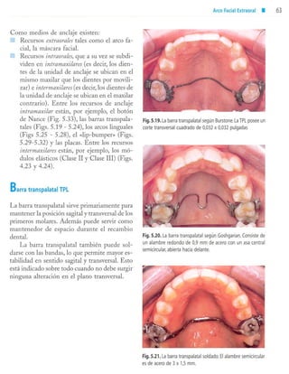 aparatología en ortopedia funcional.