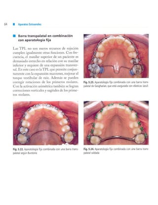 aparatología en ortopedia funcional.