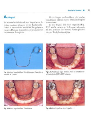 aparatología en ortopedia funcional.