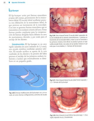 aparatología en ortopedia funcional.