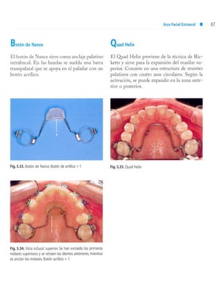 aparatología en ortopedia funcional.