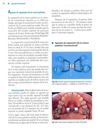 aparatología en ortopedia funcional.
