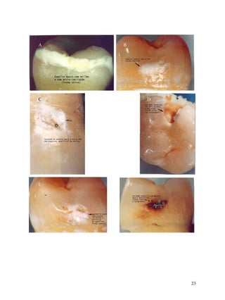 A   B




C           D




E       F




                23
 