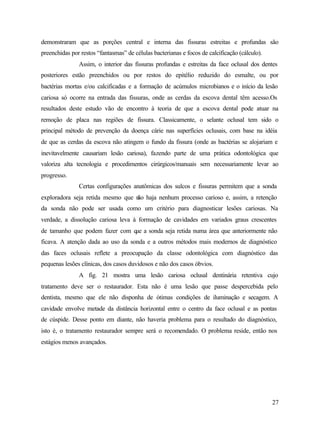 demonstraram que as porções central e interna das fissuras estreitas e profundas são
preenchidas por restos “fantasmas” de células bacterianas e focos de calcificação (cálculo).
               Assim, o interior das fissuras profundas e estreitas da face oclusal dos dentes
posteriores estão preenchidos ou por restos do epitélio reduzido do esmalte, ou por
bactérias mortas e/ou calcificadas e a formação de acúmulos microbianos e o início da lesão
cariosa só ocorre na entrada das fissuras, onde as cerdas da escova dental têm acesso.Os
resultados deste estudo vão de encontro à teoria de que a escova dental pode atuar na
remoção de placa nas regiões de fissura. Classicamente, o selante oclusal tem sido o
principal método de prevenção da doença cárie nas superfícies oclusais, com base na idéia
de que as cerdas da escova não atingem o fundo da fissura (onde as bactérias se alojariam e
inevitavelmente causariam lesão cariosa), fazendo parte de uma prática odontológica que
valoriza alta tecnologia e procedimentos cirúrgicos/manuais sem necessariamente levar ao
progresso.
               Certas configurações anatômicas dos sulcos e fissuras permitem que a sonda
exploradora seja retida mesmo que n haja nenhum processo carioso e, assim, a retenção
                                  ão
da sonda não pode ser usada como um critério para diagnosticar lesões cariosas. Na
verdade, a dissolução cariosa leva à formação de cavidades em variados graus crescentes
de tamanho que podem fazer com q a sonda seja retida numa área que anteriormente não
                                ue
ficava. A atenção dada ao uso da sonda e a outros métodos mais modernos de diagnóstico
das faces oclusais reflete a preocupação da classe odontológica com diagnóstico das
pequenas lesões clínicas, dos casos duvidosos e não dos casos óbvios.
               A fig. 21 mostra uma lesão cariosa oclusal dentinária retentiva cujo
tratamento deve ser o restaurador. Esta não é uma lesão que passe despercebida pelo
dentista, mesmo que ele não disponha de ótimas condições de iluminação e secagem. A
cavidade envolve metade da distância horizontal entre o centro da face oclusal e as pontas
de cúspide. Desse ponto em diante, não haveria problema para o resultado do diagnóstico,
isto é, o tratamento restaurador sempre será o recomendado. O problema reside, então nos
estágios menos avançados.




                                                                                               27
 