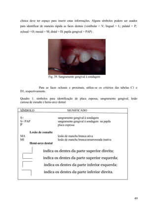 clínica deve ter espaço para inserir estas informações. Alguns símbolos podem ser usados
para identificar de maneira rápida as faces dentais (vestibular = V; lingual = L; palatal = P;
oclusal = O; mesial = M; distal = D; papila gengival = PAP) .




                       Fig. 39. Sangramento gengival à sondagem


               Para as faces oclusais e proximais, utiliza-se os critérios das tabelas C1 e
D1, respectivamente.

Quadro 1. símbolos para identificação de placa espessa, sangramento gengival, lesão
cariosa de esmalte e hemi-arco dental

SÍMBOLO                                SIGNIFICADO

S+                             sangramento gengival à sondagem
S+ PAP                         sangramento gengival à sondagem na papila
P                              placa espessa

       Lesão de esmalte
MA                             lesão de mancha branca ativa
MI                             lesão de mancha branca/amarronzada inativa
       Hemi-arco dental

                   indica os dentes da parte superior direita;
                   indica os dentes da parte superior esquerda;
                   indica os dentes da parte inferior esquerda;
                   indica os dentes da parte inferior direita.




                                                                                            49
 