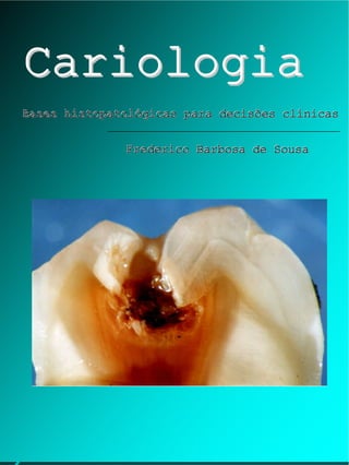 Cariologia
Bases histopatológicas para decisões clínicas
Frederico Barbosa de Sousa

 