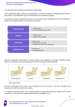 57
3.4.3 Sistemas de classificação dos dentes impactados
Foram elaborados alguns sistemas de classificação, com base em imagens radiográficas panorâmicas,
para avaliar a acessibilidade e grau de dificuldade do procedimento cirúrgico.
O sistema que utiliza a angulação do longo eixo do terceiro molar impactado, tendo como referência o
longo eixo do segundo molar, é o sistema mais utilizado.
Além das angulações supracitadas, os dentes podem estar angulados na direção vestibular, lingual,
palatina e, raramente, transversal (posição horizontal na direção vestibulolingual)
Figura 8: Hupp et al., 2009.
Já outra classificação muito usada e que é figurinha certa nas provas é a de Pell e Gregory. Essa
classificação avalia dois aspectos principais:
1- a relação do terceiro molar com a margem anterior do ramo (quantidade de espaço entre o ramo
mandibular e a face distal do segundo molar inferior): CLASSES 1, 2 e 3.
MESIOANGULAR VERTICAL HORIZONTAL DISTOANGULAR
• 43% dos casos
• menor dificuldade para remoção
MESIOANGULAR
• 38% dos casos
• segunda mais frequente
VERTICAL
• 3% dos casos
• perpendicular ao 2º molar
• remoção mais difícil que o mesioangular
HORIZONTAL
• 6% dos casos
• remoção mais difícil
DISTOANGULAR
Cássia Franco Della Mea Reginato, Mirela Sangoi Barreto
Aula 00 (Profª. Cássia Reginato)
Odontologia p/ Concursos - Curso Regular (Com Videoaulas) 2020
www.estrategiaconcursos.com.br
0
00000000000 - DEMO
 