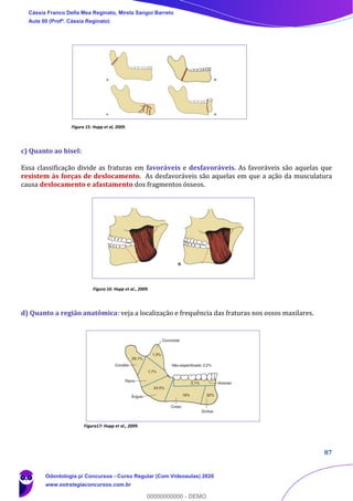 87
Figura 15: Hupp et al, 2009.
c) Quanto ao bisel:
Essa classificação divide as fraturas em favoráveis e desfavoráveis. As favoráveis são aquelas que
resistem às forças de deslocamento. As desfavoráveis são aquelas em que a ação da musculatura
causa deslocamento e afastamento dos fragmentos ósseos.
Figura 16: Hupp et al., 2009.
d) Quanto a região anatômica: veja a localização e frequência das fraturas nos ossos maxilares.
Figura17: Hupp et al., 2009.
Cássia Franco Della Mea Reginato, Mirela Sangoi Barreto
Aula 00 (Profª. Cássia Reginato)
Odontologia p/ Concursos - Curso Regular (Com Videoaulas) 2020
www.estrategiaconcursos.com.br
0
00000000000 - DEMO
 