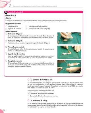 Instrumental, materiales y procedimientos clínicos en odontología conservadora7
134
C.  Cemento de fosfato de zinc
Es uno de los cementos más antiguos, que va siendo sustituido por otros. Contiene óxido
de zinc y ácido fosfórico. Es muy resistente, aunque libera calor durante su fraguado,
por lo que es dañino para la pulpa. El mezclado es muy similar al del ZOE, pero mucho
más rápido. Se emplea la loseta de vidrio.
Las aplicaciones actuales principales son:
•	 Obturación provisional de cavidades.
•	 Cementado definitivo de coronas y puentes.
D.  Hidróxido de calcio
Es un material que induce la reparación de la dentina. El calcio que desprende este
cemento tiene acción bactericida (elimina bacterias) y estimula la formación de dentina.
En la Unidad 8 se explica en mayor detalle.
Protocolo de actuación 2
Batido de ZOE
Objetivo:
Conseguir un cemento con características idóneas para su empleo como obturación provisional.
Equipamiento necesario:
•	 Loseta de vidrio.
•	 Espátula de cemento.
•	 Instrumento de bola-espátula.
•	 Envases de ZOE (polvo y líquido).
Proceso operativo:
1.	 Dosificación del polvo
Se añade polvo en función de la consistencia deseada. Debe dividirse el
polvo en líneas con la espátula, para facilitar su inclusión en la mezcla.
2.	 Dosificación del líquido
Habitualmente, se añade una gota de eugenol, alejada del polvo.
3.	 Primera fase de mezclado
Se va añadiendo polvo de forma sucesiva a la gota de eugenol, y se
realiza un batido en rotación.
4.	 Segunda fase de mezclado
Una vez que la mezcla va tomando consistencia, se realiza un movimien-
to similar al de untar mantequilla, tal como se comentaba con el CIV.
5.	 Recogida del cemento
Si la mezcla es fluida, se recoge con un instrumento de bola-espátula. Si
la mezcla es consistente, se puede modelar con los dedos en forma de
bola para introducirla en la cavidad.
 