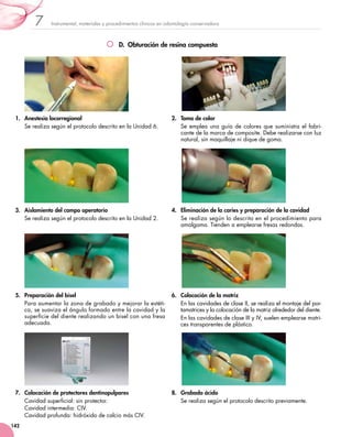 Instrumental, materiales y procedimientos clínicos en odontología conservadora7
142
D.  Obturación de resina compuesta
1.	 Anestesia locorregional
Se realiza según el protocolo descrito en la Unidad 6.
2.	 Toma de color
Se emplea una guía de colores que suministra el fabri-
cante de la marca de composite. Debe realizarse con luz
natural, sin maquillaje ni dique de goma.
3.	 Aislamiento del campo operatorio
Se realiza según el protocolo descrito en la Unidad 2.
4.	 Eliminación de la caries y preparación de la cavidad
Se realiza según lo descrito en el procedimiento para
amalgama. Tienden a emplearse fresas redondas.
5.	 Preparación del bisel
Para aumentar la zona de grabado y mejorar la estéti-
ca, se suaviza el ángulo formado entre la cavidad y la
superficie del diente realizando un bisel con una fresa
adecuada.
6.	 Colocación de la matriz
En las cavidades de clase II, se realiza el montaje del por-
tamatrices y la colocación de la matriz alrededor del diente.
En las cavidades de clase III y IV, suelen emplearse matri-
ces transparentes de plástico.
7.	 Colocación de protectores dentinopulpares
Cavidad superficial: sin protector.
Cavidad intermedia: CIV.
Cavidad profunda: hidróxido de calcio más CIV.
8.	 Grabado ácido
Se realiza según el protocolo descrito previamente.
 