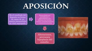 Odontologia infantil | PPTX