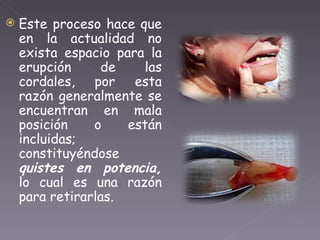 Este proceso hace que en la actualidad no exista espacio para la erupción de las cordales, por esta razón generalmente se encuentran en mala posición o están incluidas; constituyéndose  quistes en potencia,  lo cual es una razón para retirarlas.  