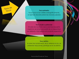 Tipos de focosUniversidad Privada de Tacna