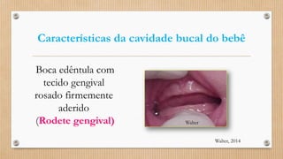 Características da cavidade bucal do bebê
Boca edêntula com
tecido gengival
rosado firmemente
aderido
(Rodete gengival) Walter
Walter, 2014
 