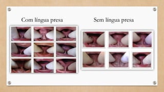 Com língua presa Sem língua presa
 