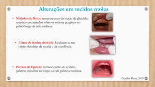 Alterações em tecidos moles
• Nódulos de Bohn: remanescentes de tecido de glândulas
mucosas encontrados sobre os rodetes gengivais no
palato longe da rafe mediana.
• Pérolas de Epstein: remanescentes do epitélio
palatino incluídos ao longo da rafe palatina mediana.
• Cistos de lâmina dentária: localizam-se nas
cristas dentárias da maxila e da mandíbula.
Guedes Pinto, 2009
 
