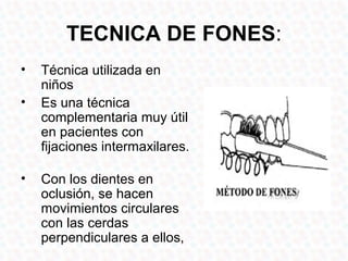 TECNICA DE FONES:
•   Técnica utilizada en
    niños
•   Es una técnica
    complementaria muy útil
    en pacientes con
    fijaciones intermaxilares.

•   Con los dientes en
    oclusión, se hacen
    movimientos circulares
    con las cerdas
    perpendiculares a ellos,
 