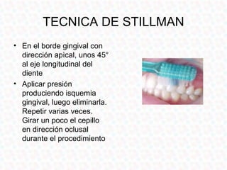 TECNICA DE STILLMAN
• En el borde gingival con
  dirección apìcal, unos 45°
  al eje longitudinal del
  diente
• Aplicar presión
  produciendo isquemia
  gingival, luego eliminarla.
  Repetir varias veces.
  Girar un poco el cepillo
  en dirección oclusal
  durante el procedimiento
 